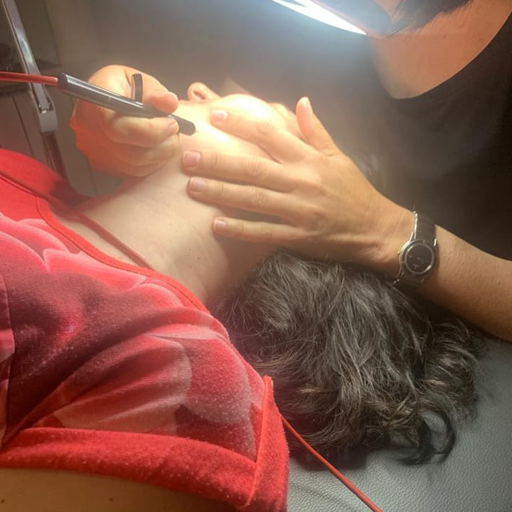 Depilación Eléctrica